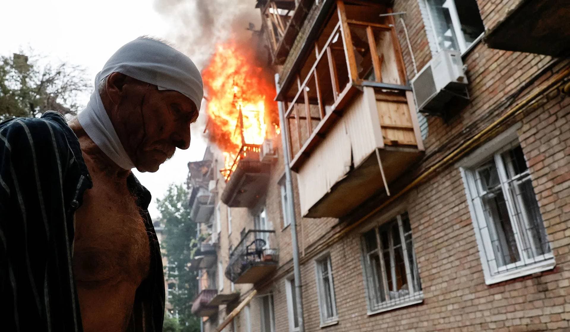 An injured resident stands outside his damaged house during Russian missile and drone strikes in Kyiv